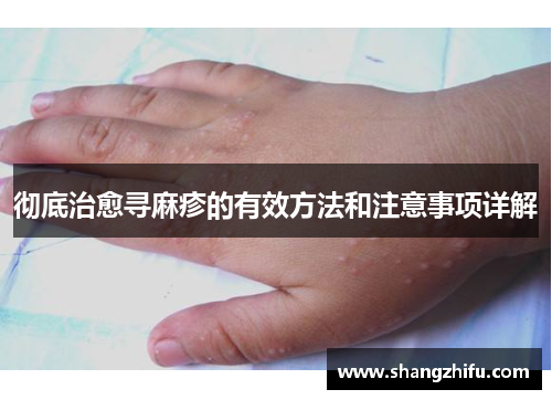 彻底治愈寻麻疹的有效方法和注意事项详解